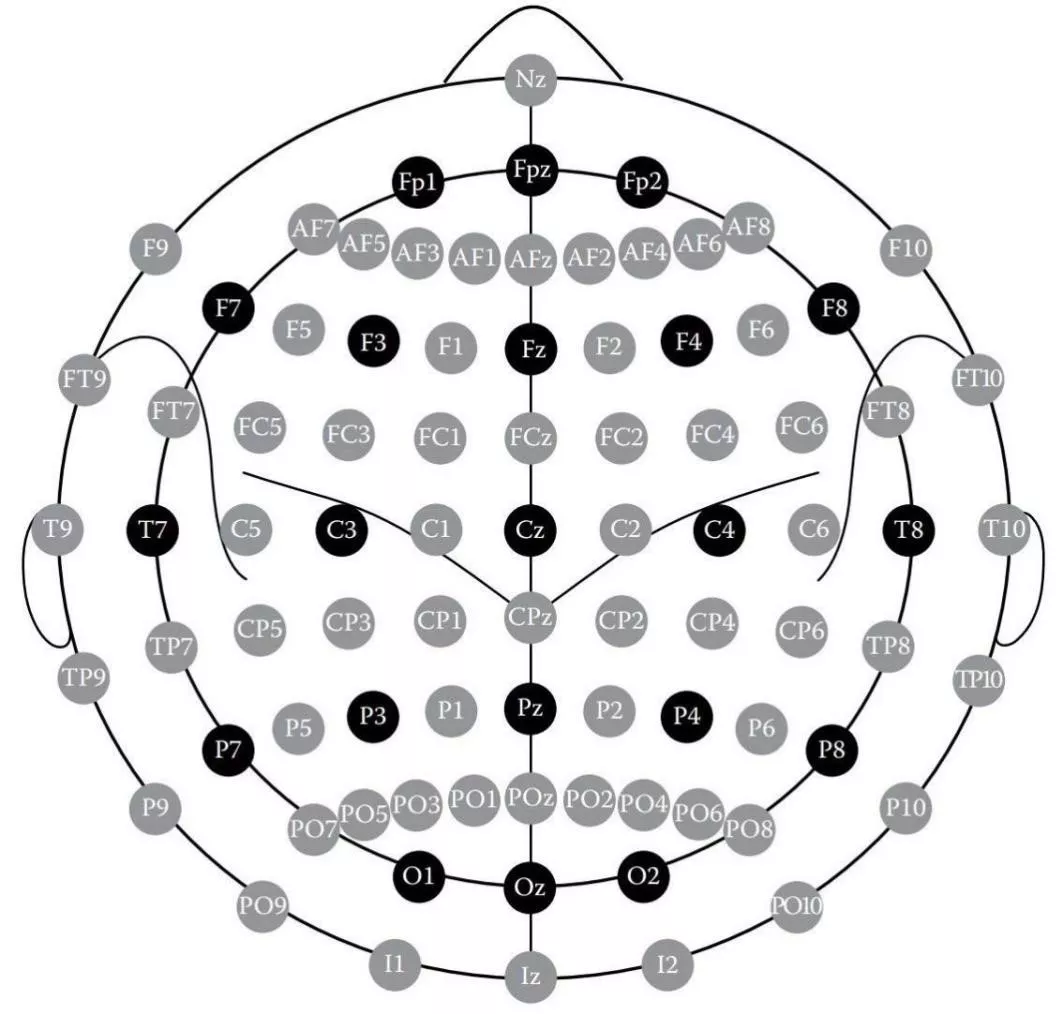 10-20與10-10腦電l圖系統(tǒng)與腦功能分區(qū)定位